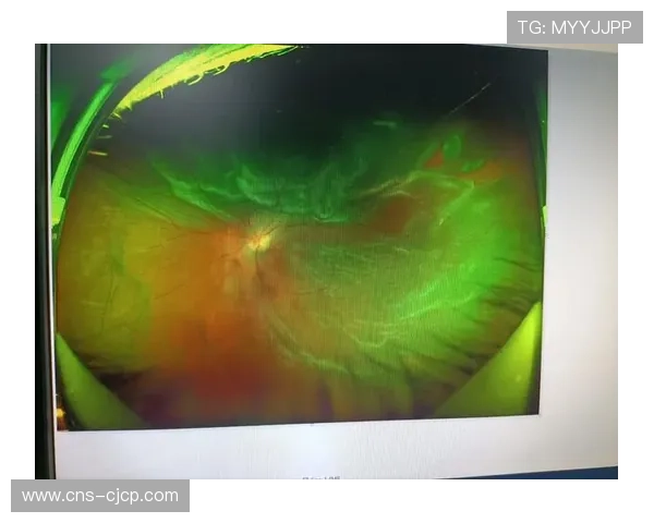 眼科专家李东益公开指责阿斯皮纳尔在眼伤上撒谎：手术仅为近视矫正，非治疗外伤所致